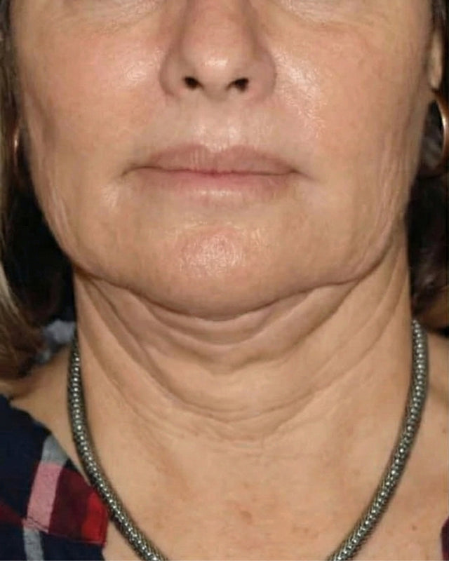 Prima