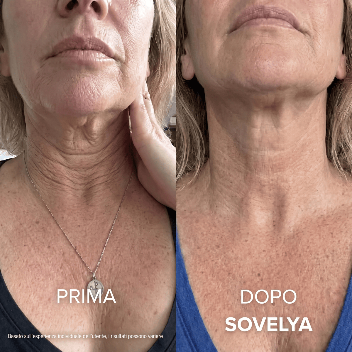 Crema Collo Rassodante e Liftante