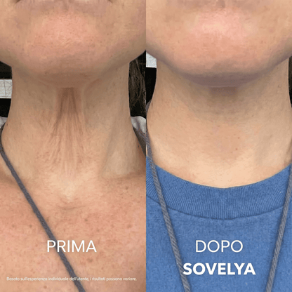 Crema Collo Rassodante e Liftante