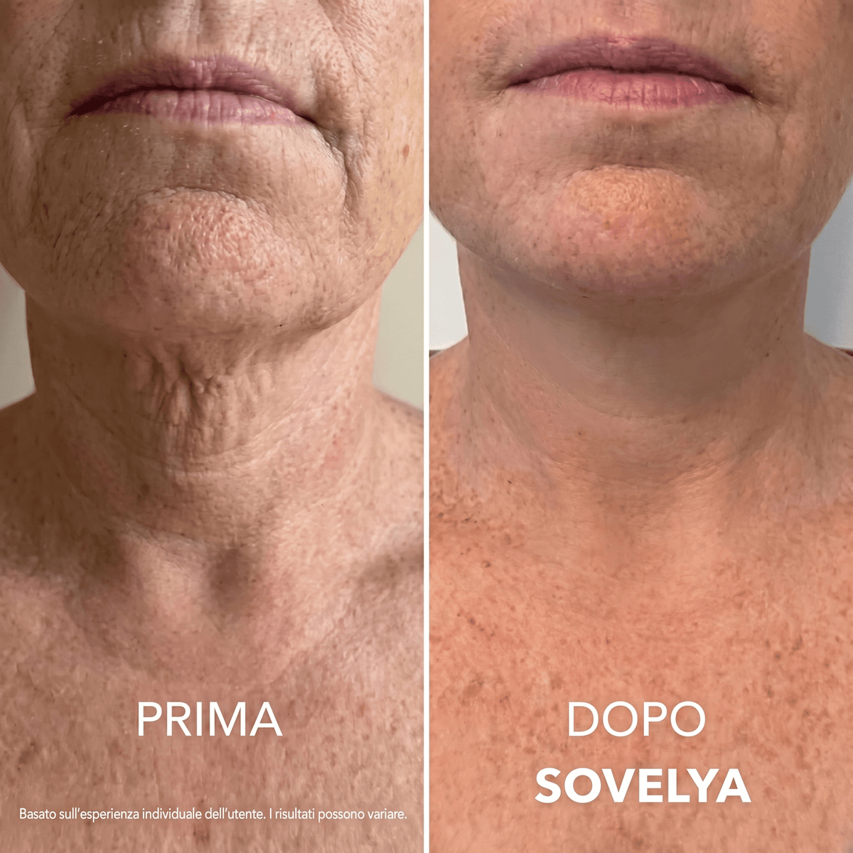 Crema Collo Rassodante e Liftante